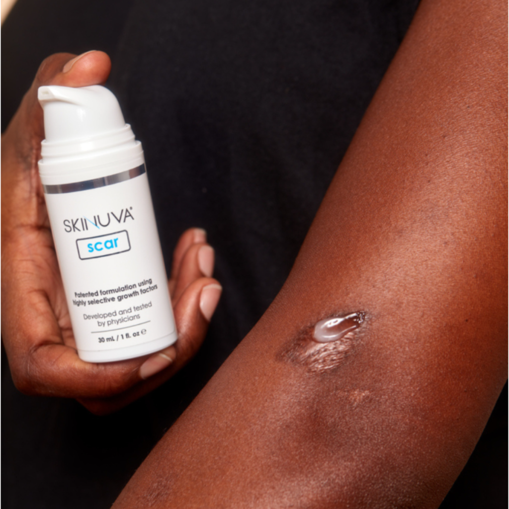 Skinuva Scar điều trị sẹo phẫu thuật như thế nào?