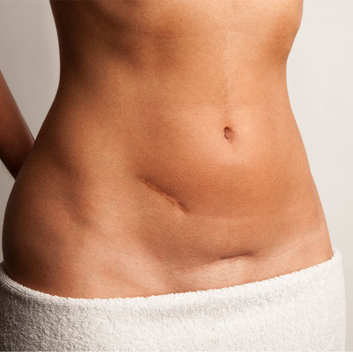 Trị sẹo phẫu thuật là điều trăn trở của rất nhiều người