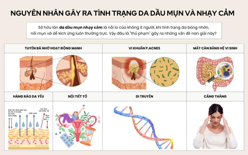 Nguyên nhân tiềm ẩn gây ra tình trạng da dầu mụn