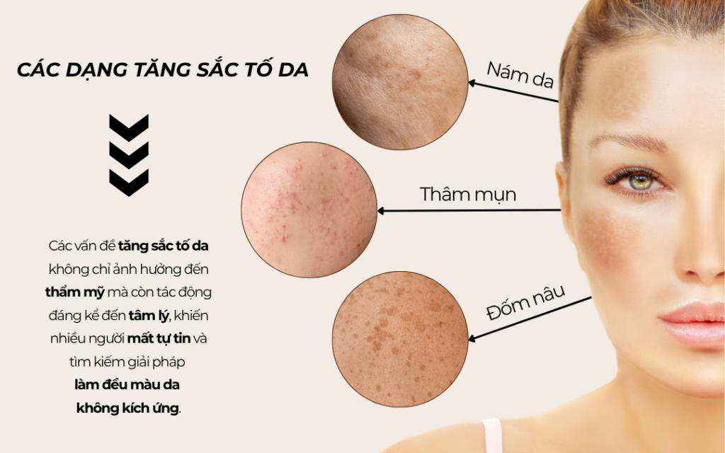 Tăng sắc tố - Vấn đề nan giải không của riêng ai