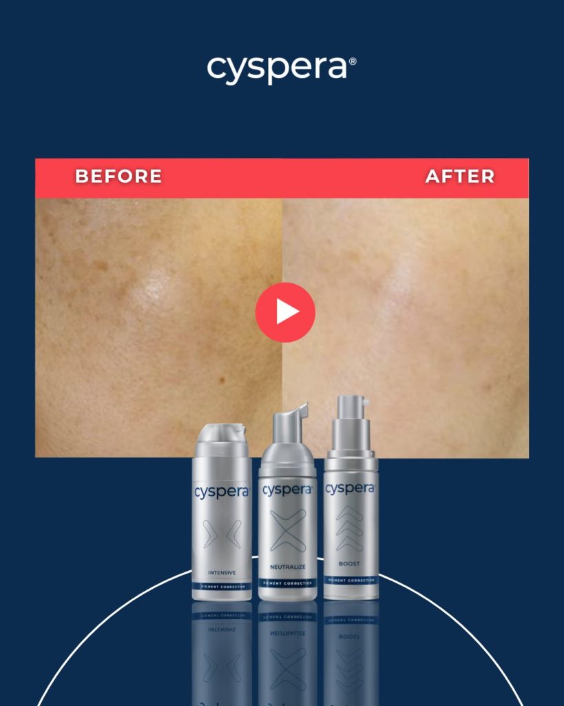 Cyspera Intensive System gồm bộ 3 sản phẩm Cyspera Intensive - Cyspera Neutralize - Cyspera Boost