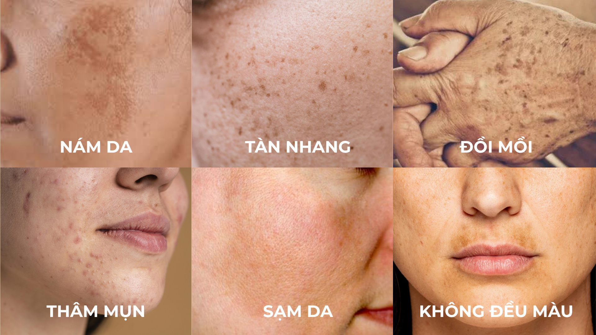 Làm sáng da là điều mà rất nhiều người đang trăn trở