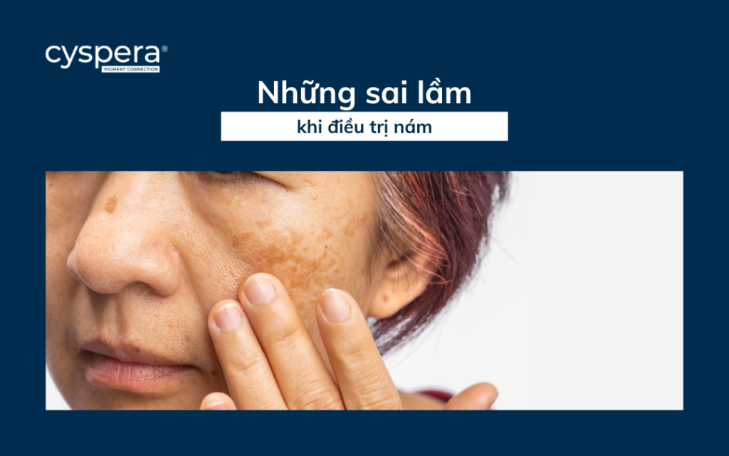 Nhưng sai lầm phổ biến khi điều trị nám
