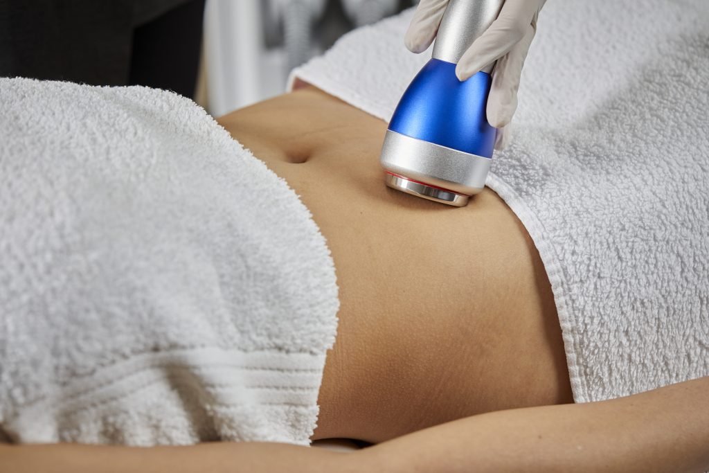 Công nghệ Ultrasound điêu khắc vóc dáng