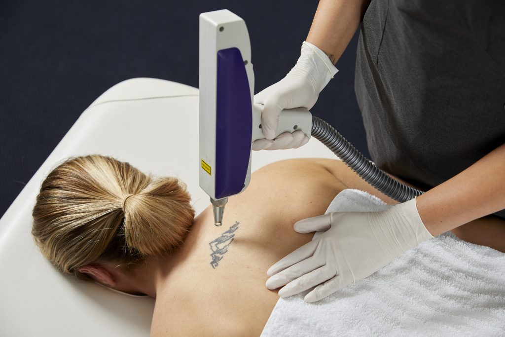 Tay cầm Laser Q-Switched Nd:YAG - UltraLUX PRO