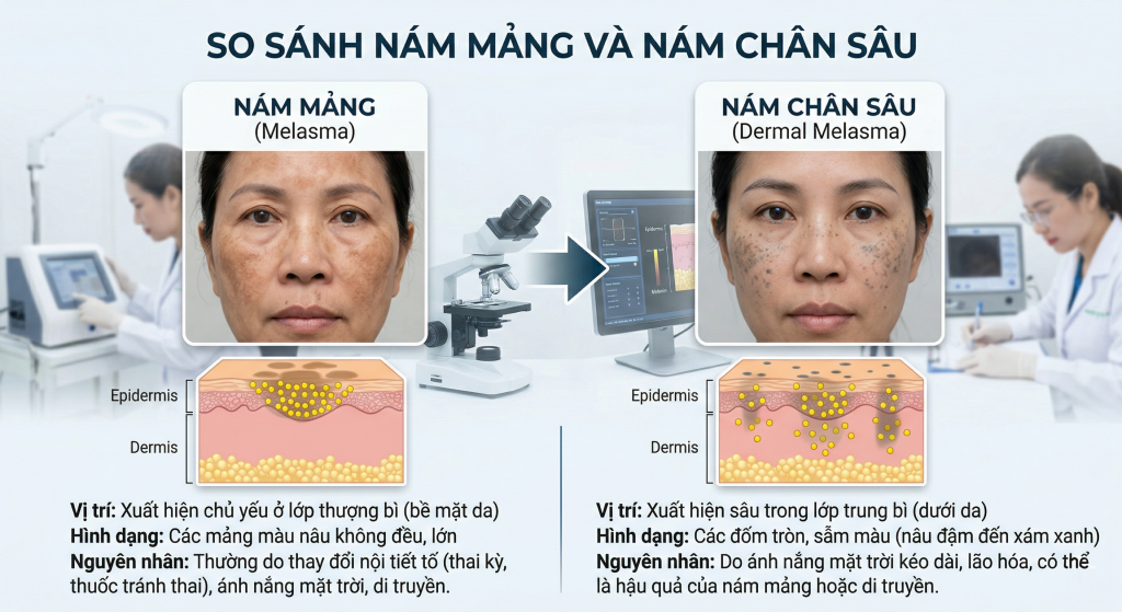 Phân biệt nám mảng và nám chân sâu