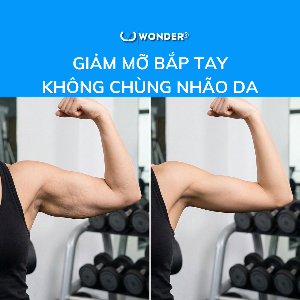 Công nghệ Wonder Axon: Giảm mỡ bắp tay không chùng nhão da