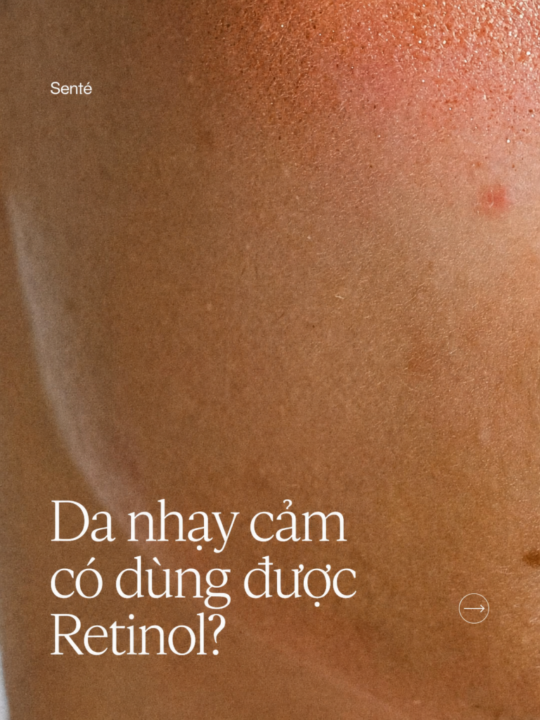 Da nhạy cảm có nên dùng Retinol không?