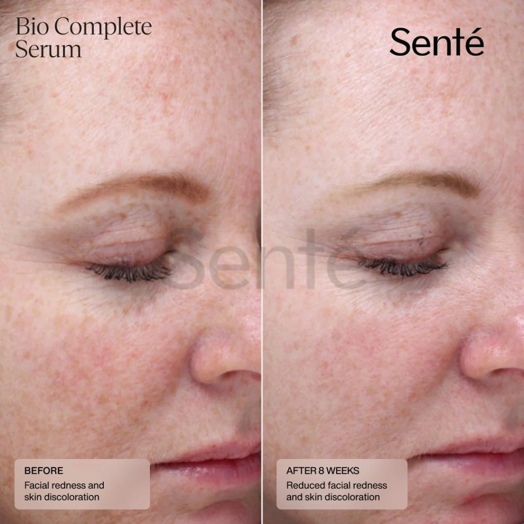 Kết quả sử dụng Retinol cho da nhạy cảm