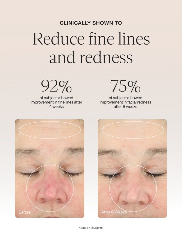 Kết quả sử dụng Retinol kết hợp HSA